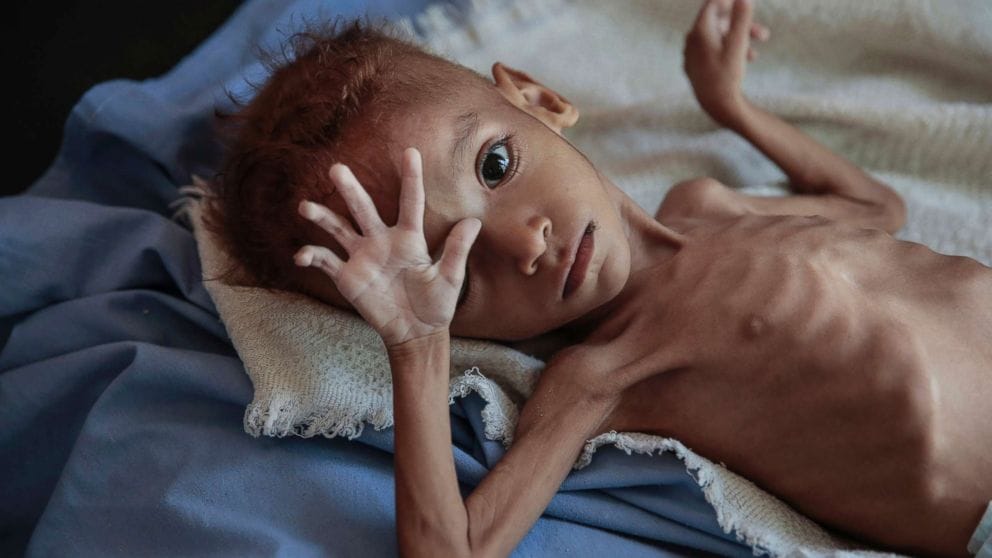 Image from: WARNING: Bill Gates Warns That The World Is Going 'Backwards'; Claims Next 5 Years Would Be Difficult For Humanity