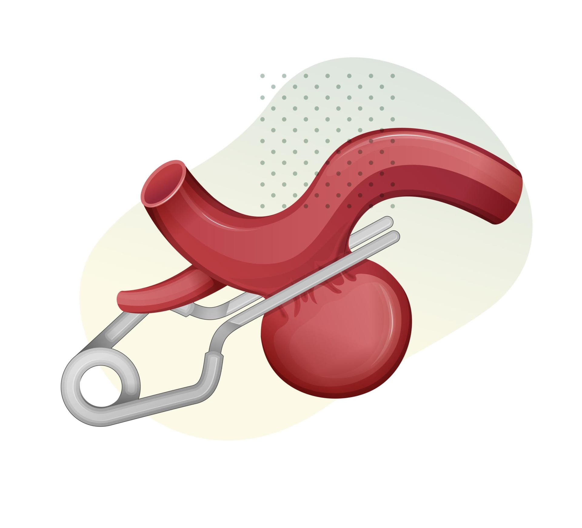 Image from: Brain Aneurysms: What the Public Should Know